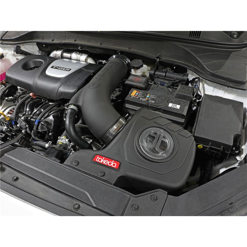 aFe Power | Takeda Momentum Cold Air Intake w/Pro DRY S - Kona 1.6T 2018-2021