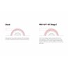 Eibach | Set of 4 Shocks + 4 Springs - Tacoma 2.4T 2024-2026